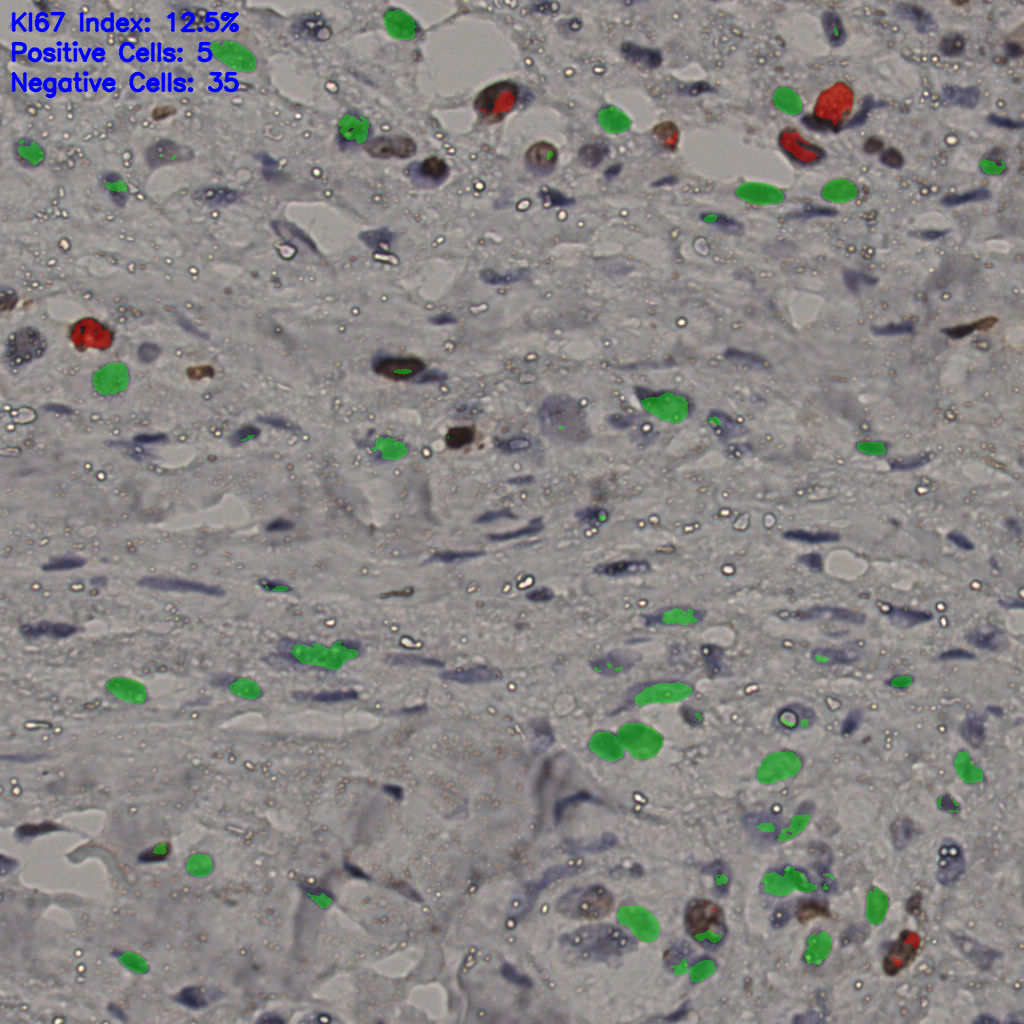 slice_25_24_x22400_y21504.png