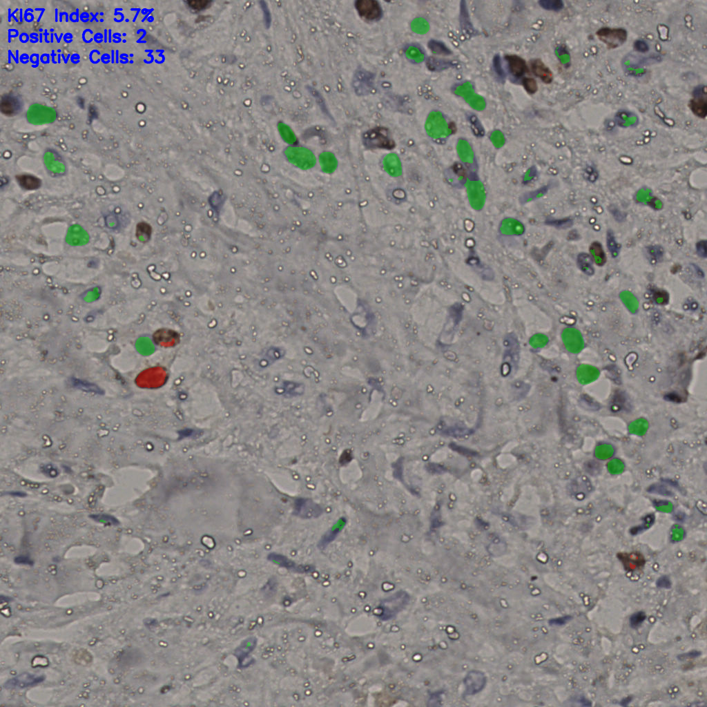 slice_25_26_x22400_y23296.png