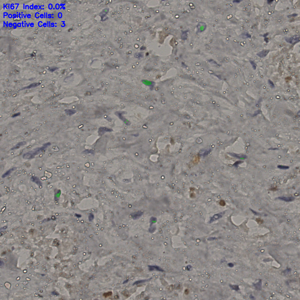 slice_25_27_x22400_y24192.png