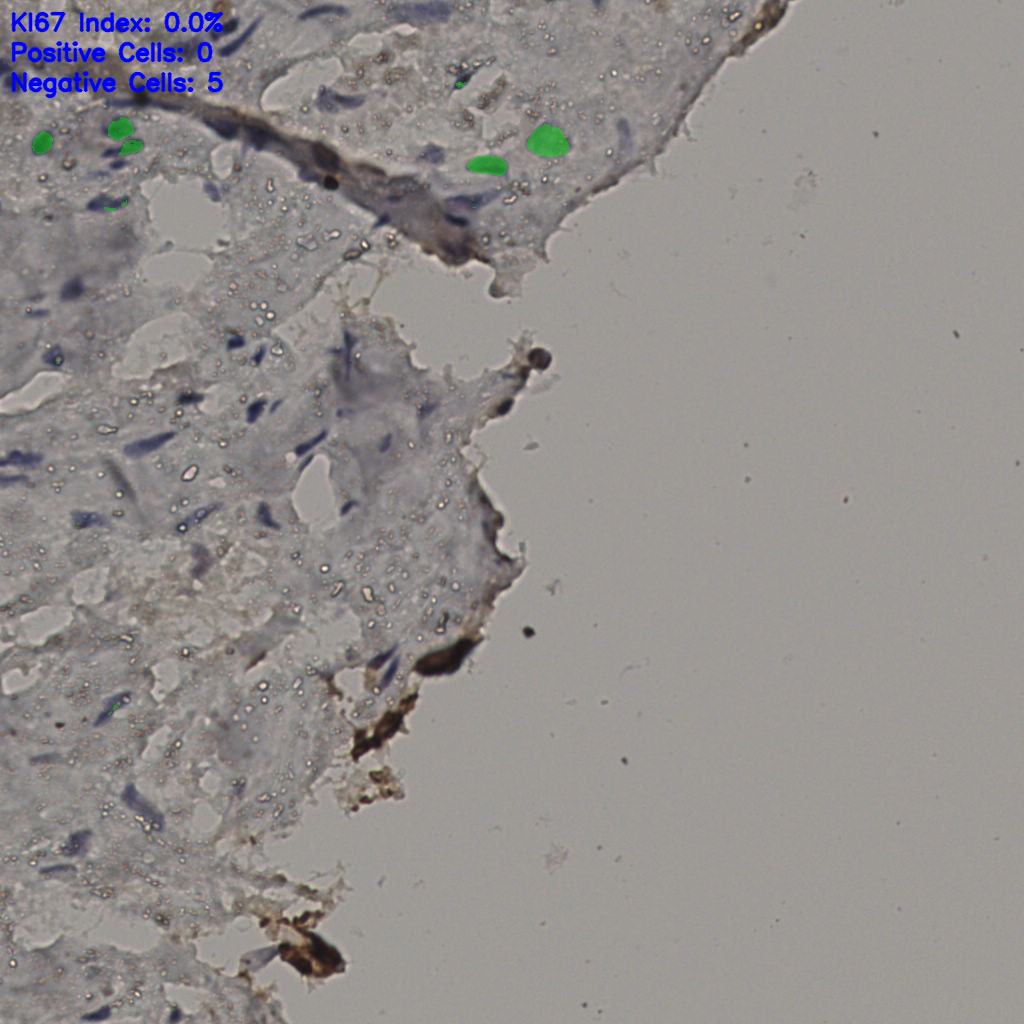 slice_25_29_x22400_y25984.png