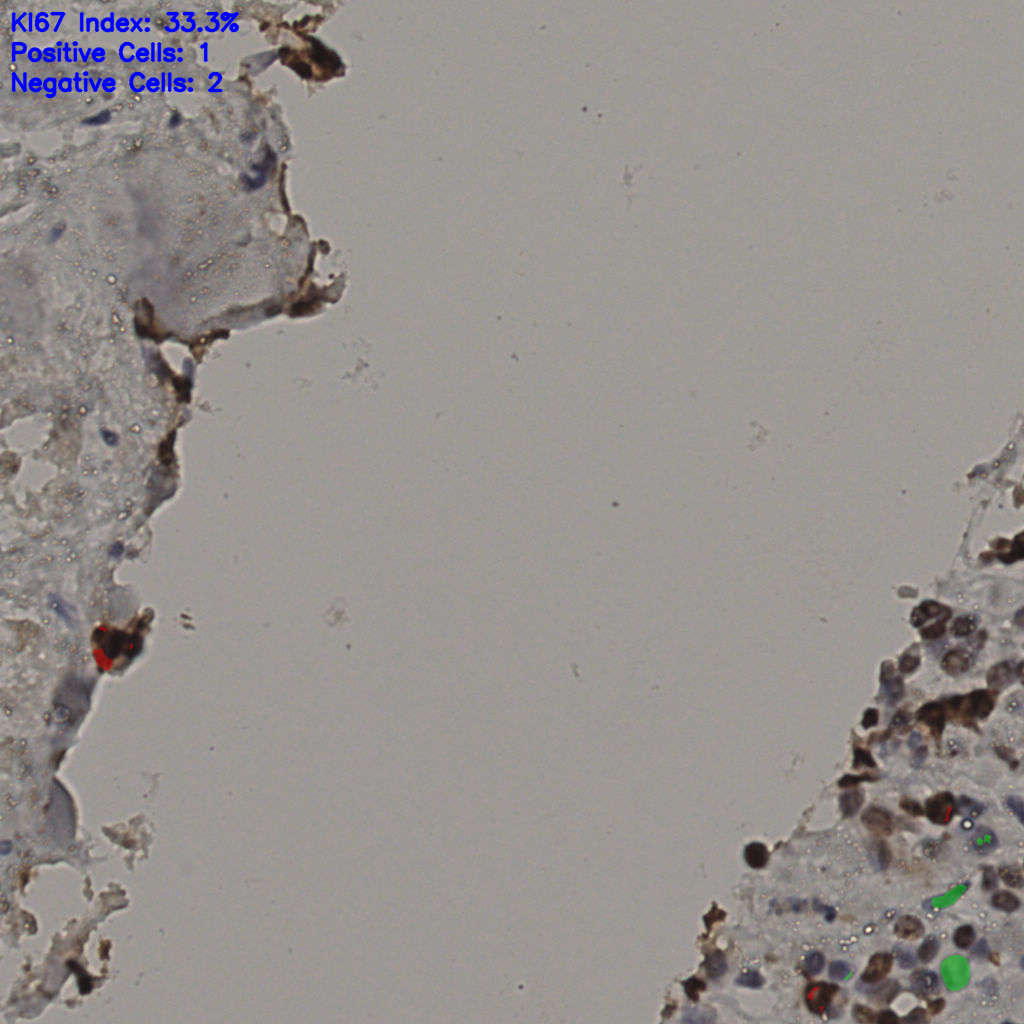 slice_25_30_x22400_y26880.png