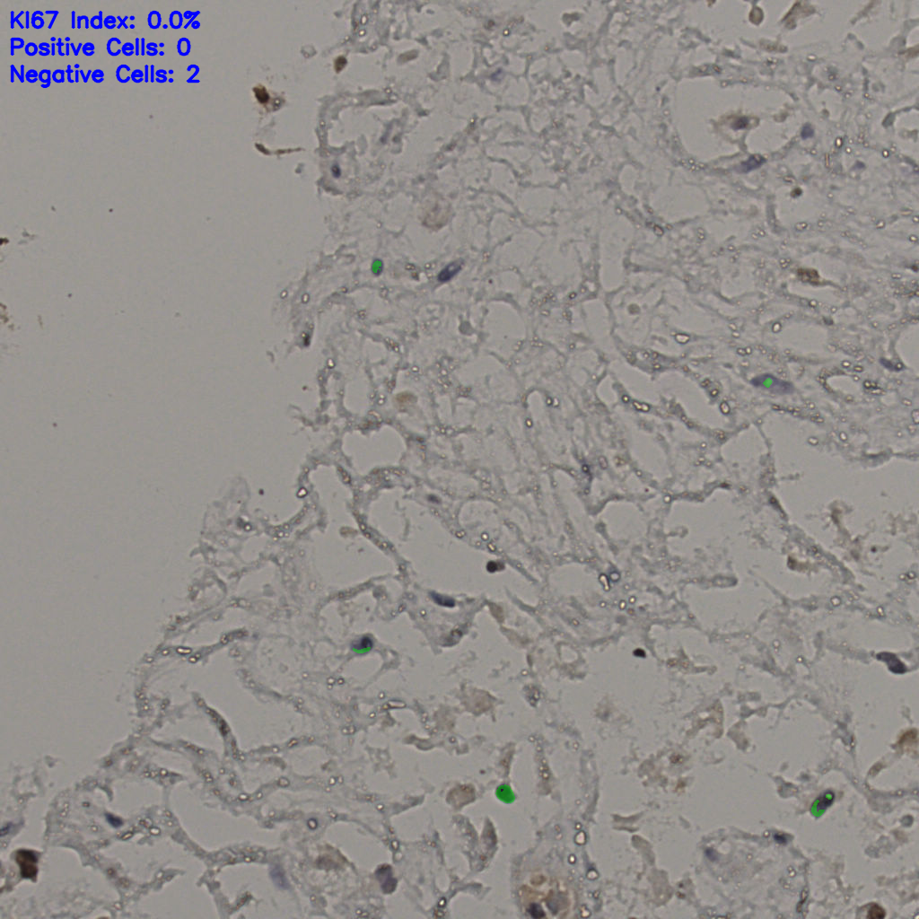slice_25_38_x22400_y34048.png