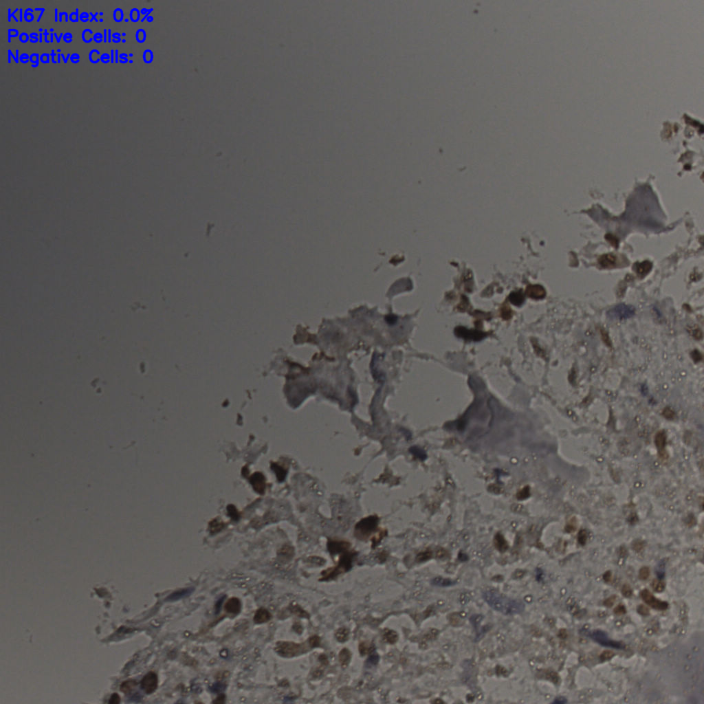 slice_26_21_x23296_y18816.png