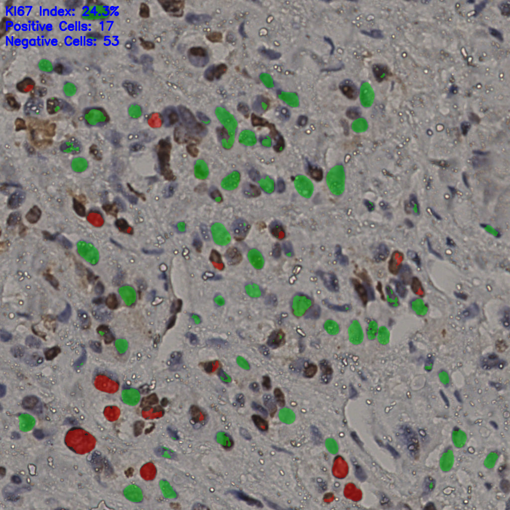 slice_26_25_x23296_y22400.png