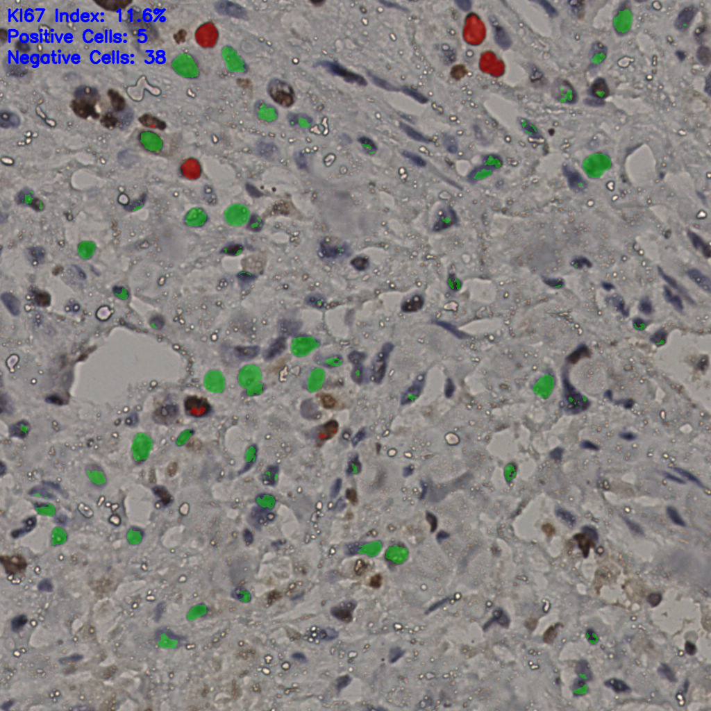 slice_26_26_x23296_y23296.png