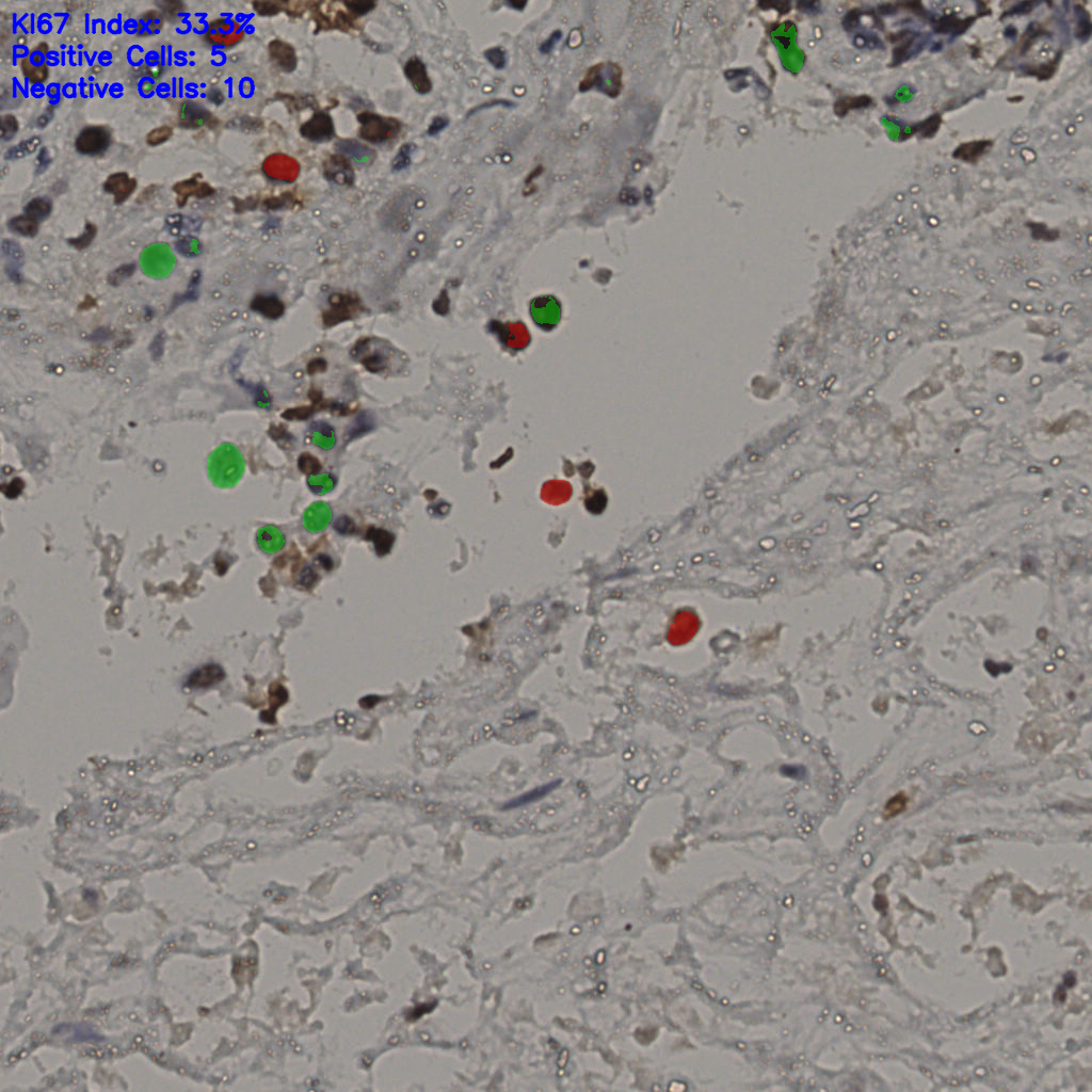 slice_26_36_x23296_y32256.png