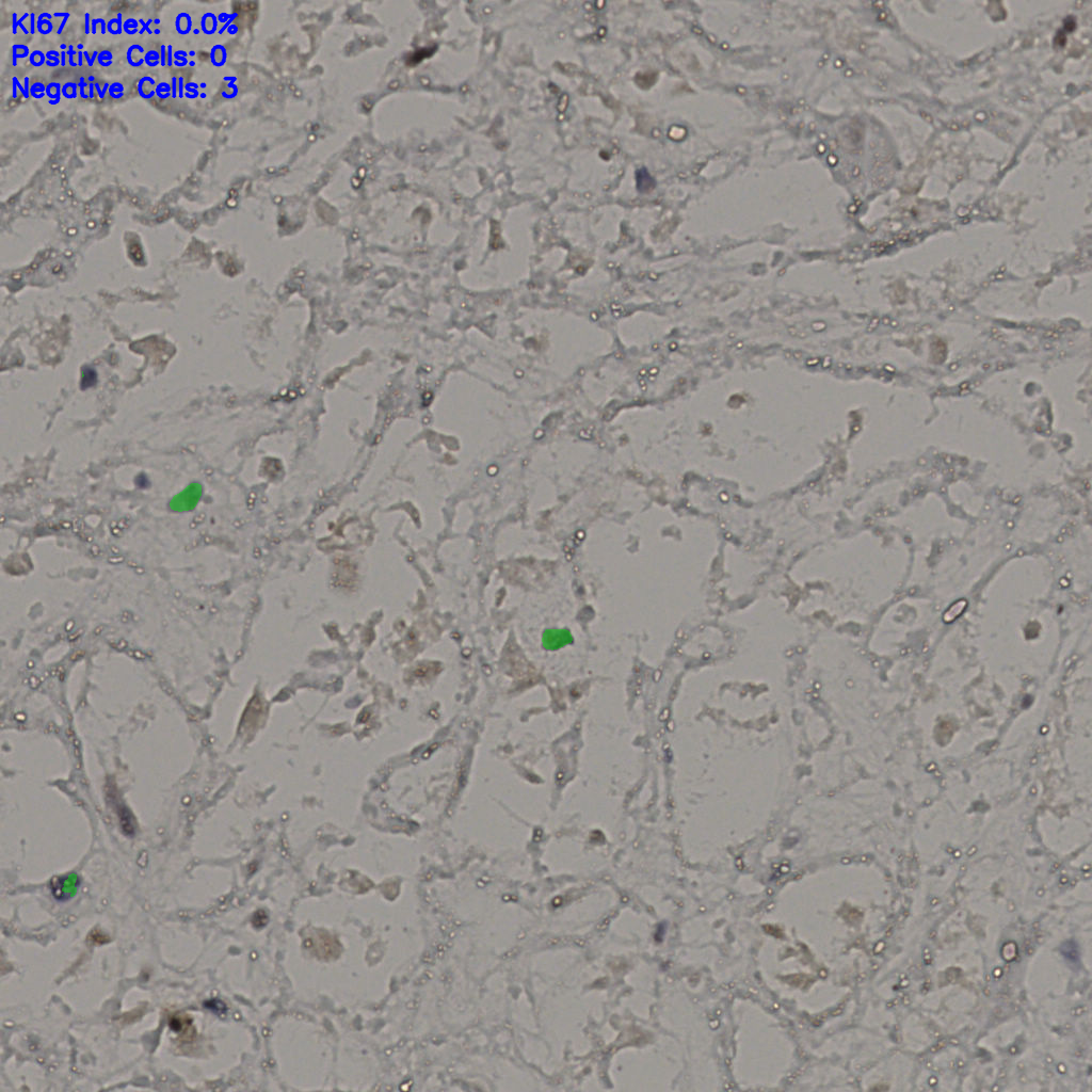 slice_26_37_x23296_y33152.png