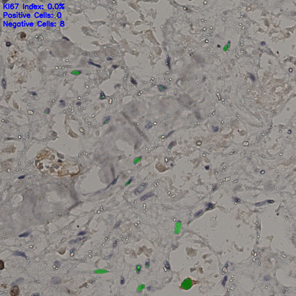 slice_26_39_x23296_y34944.png