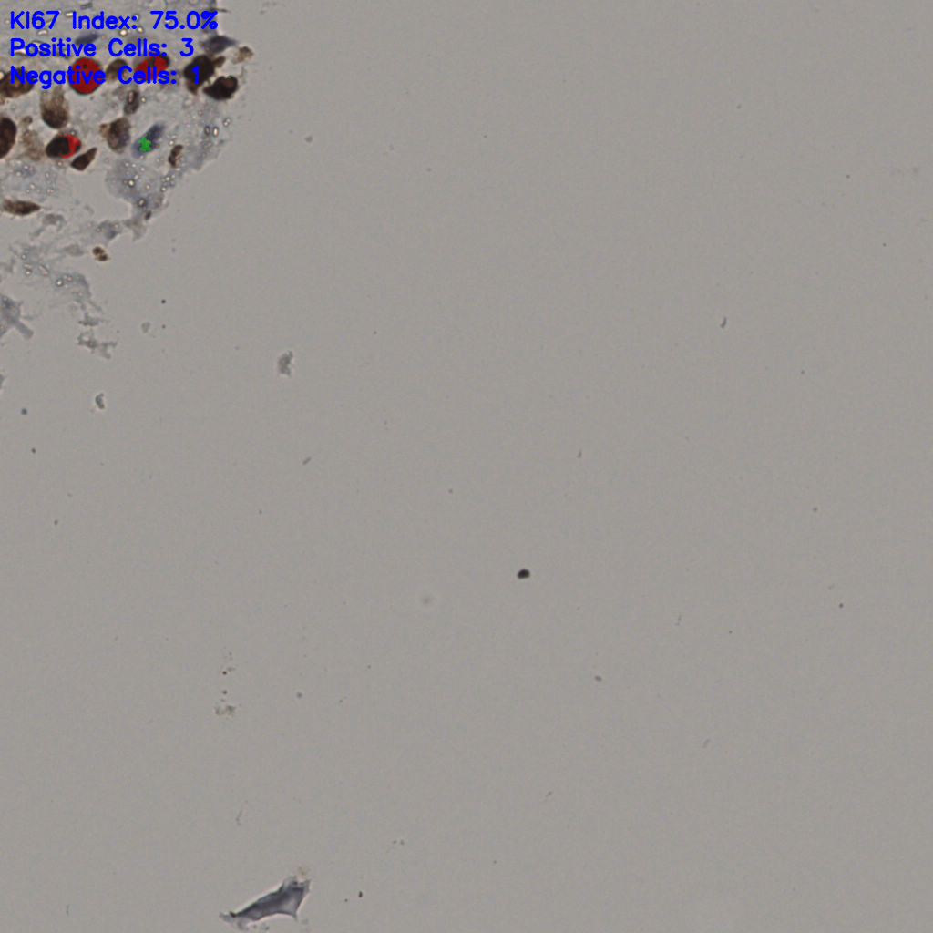 slice_26_45_x23296_y40320.png