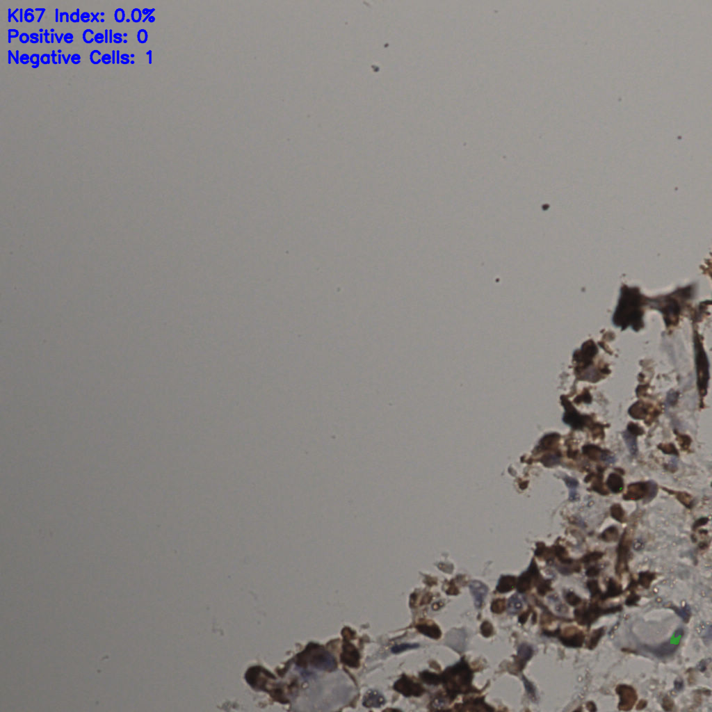 slice_27_20_x24192_y17920.png