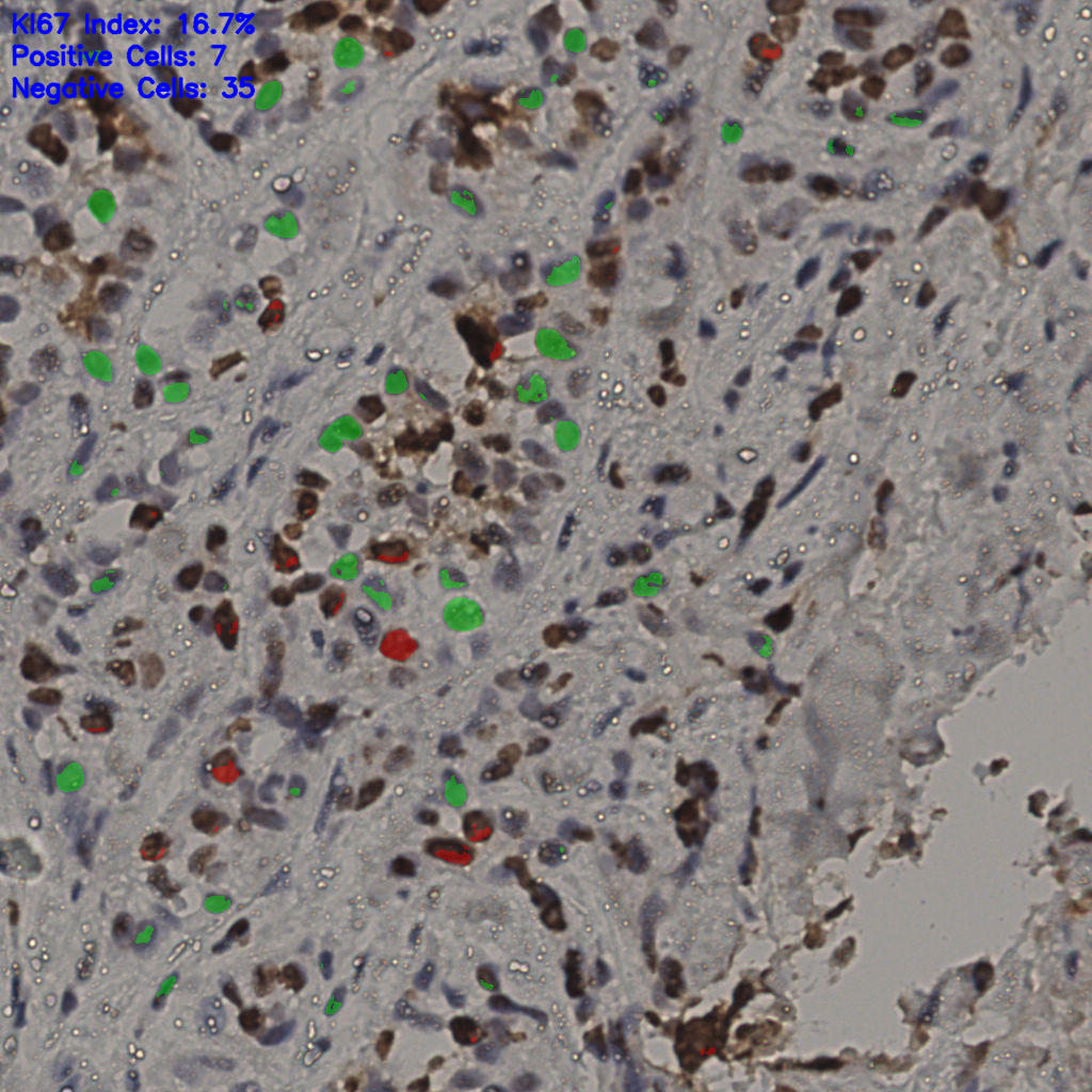 slice_27_34_x24192_y30464.png