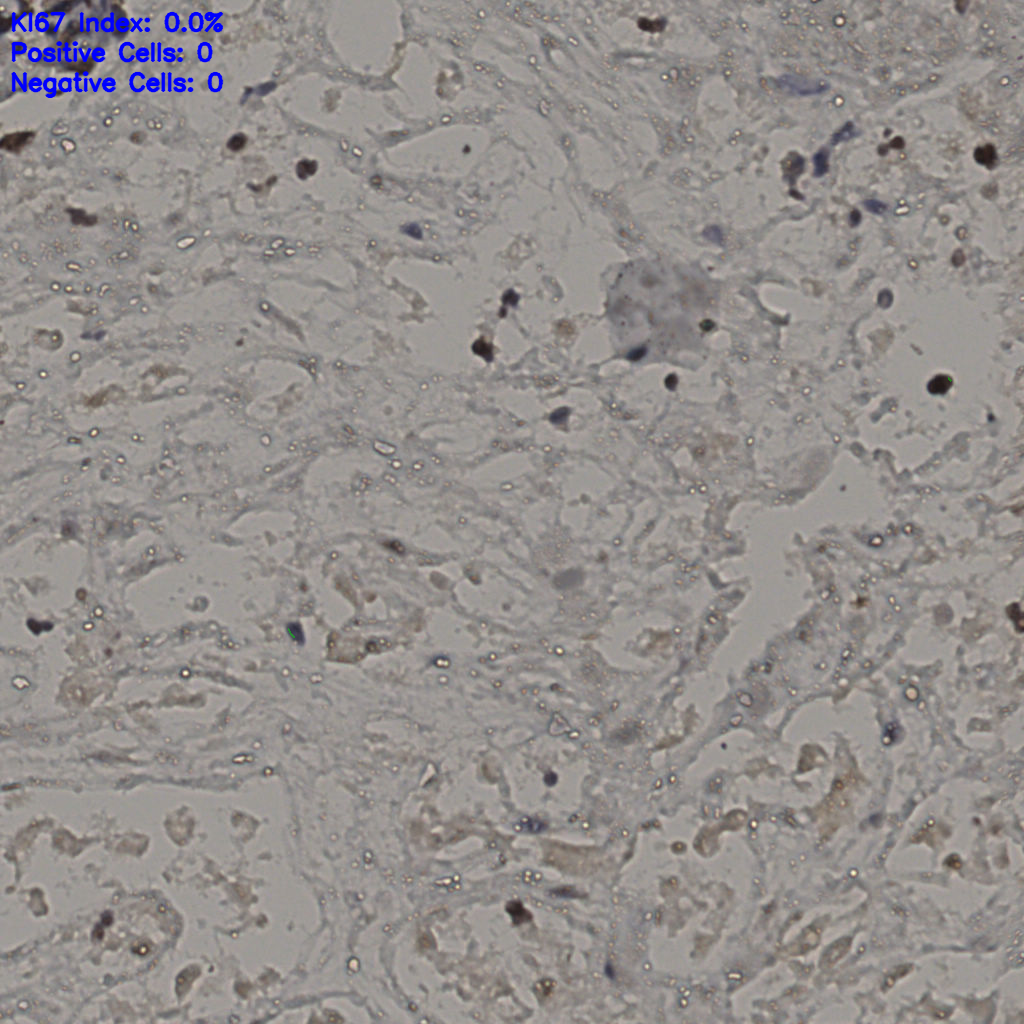 slice_27_36_x24192_y32256.png