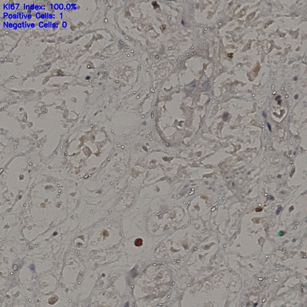 slice_27_37_x24192_y33152.png