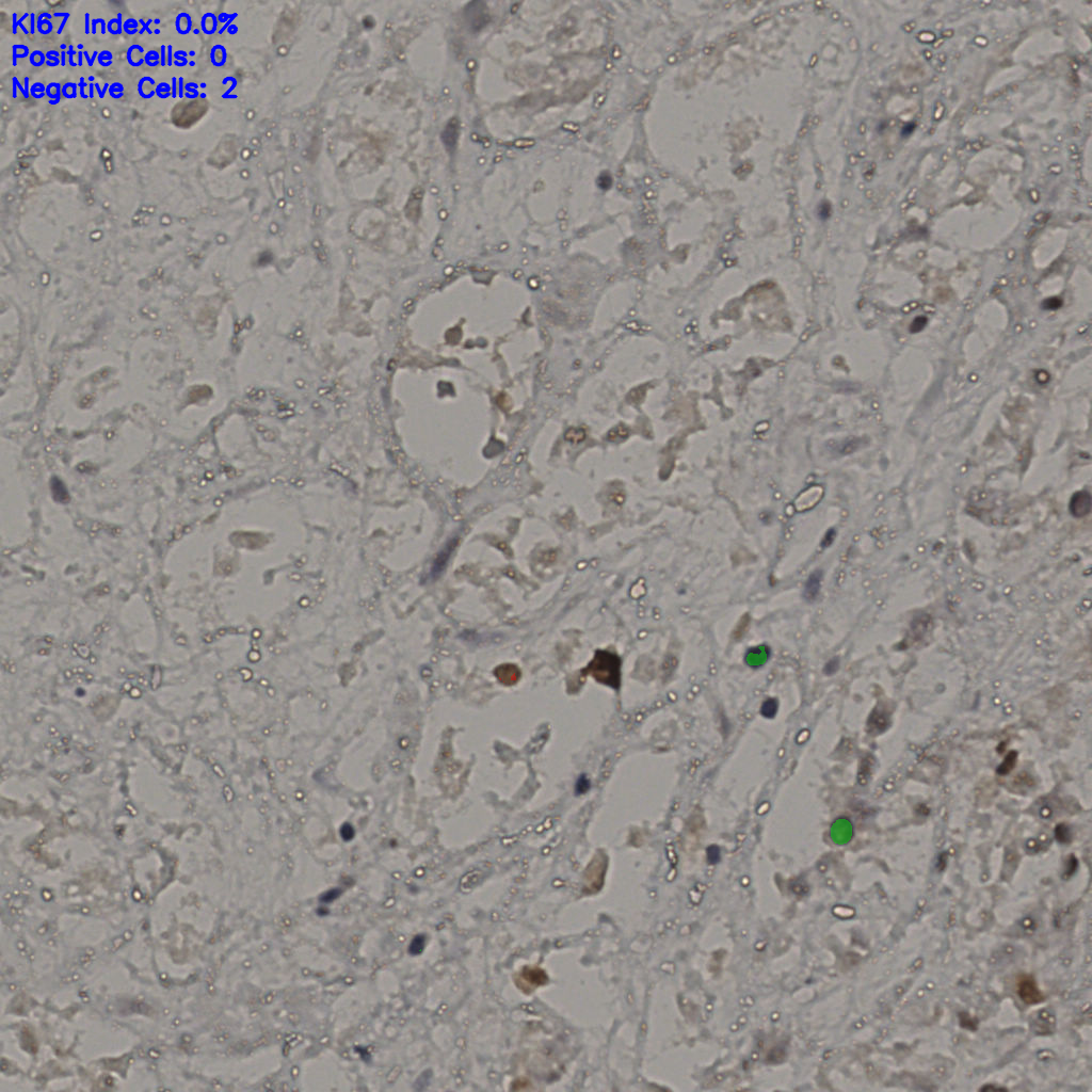 slice_27_38_x24192_y34048.png
