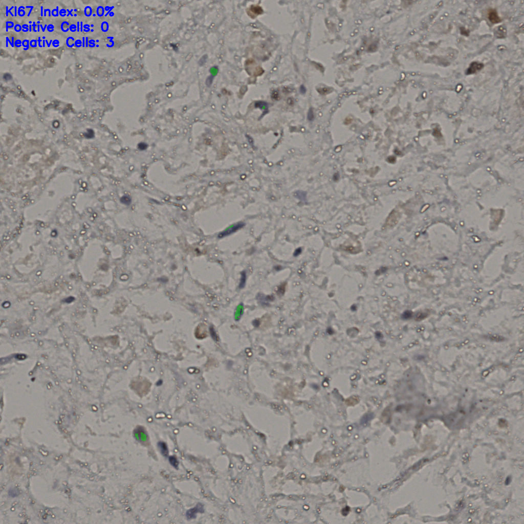 slice_27_39_x24192_y34944.png