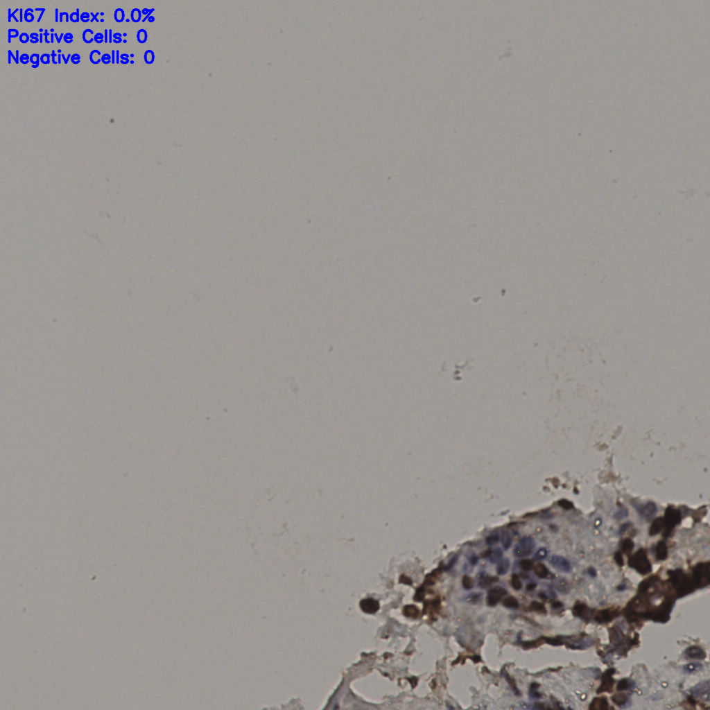slice_28_19_x25088_y17024.png