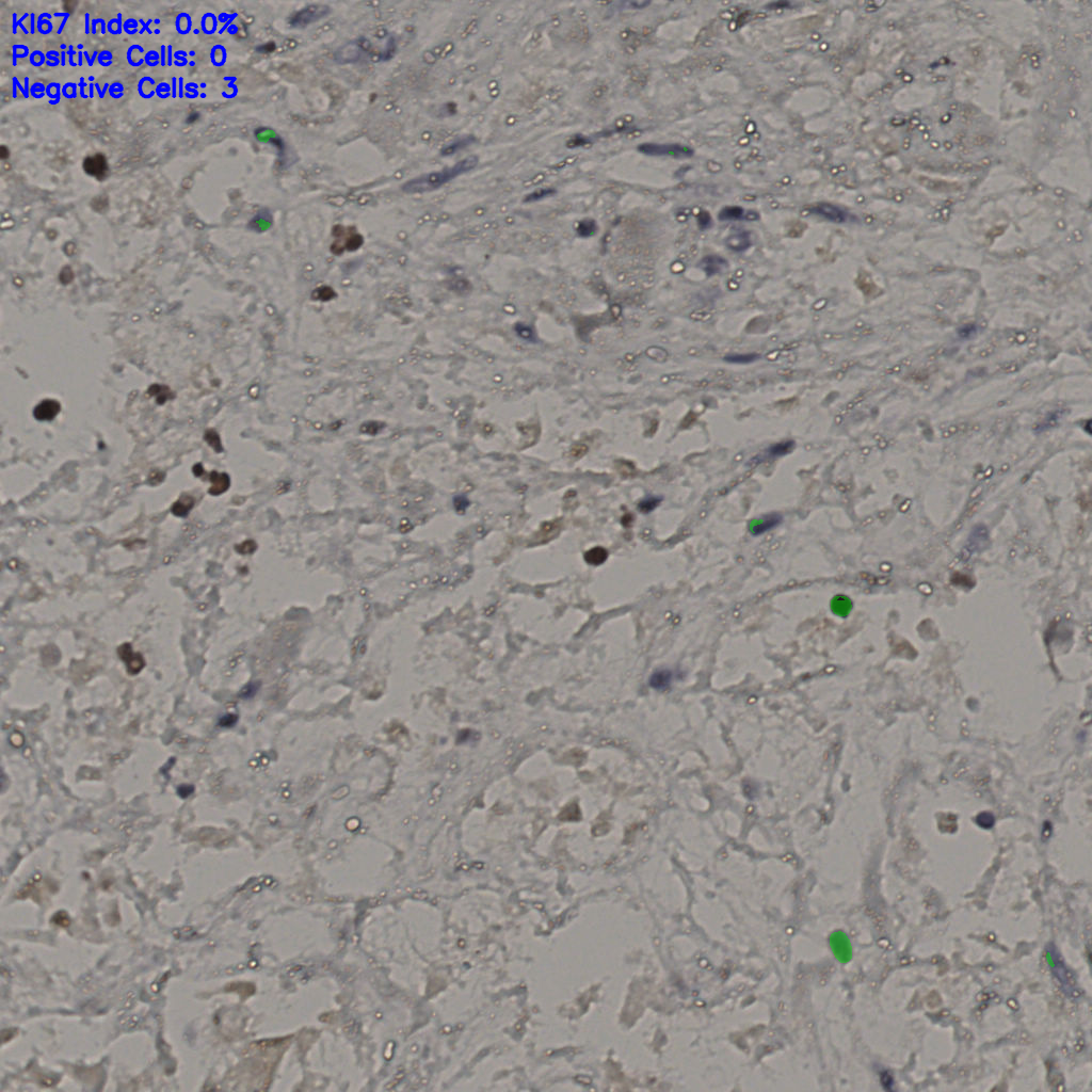 slice_28_36_x25088_y32256.png