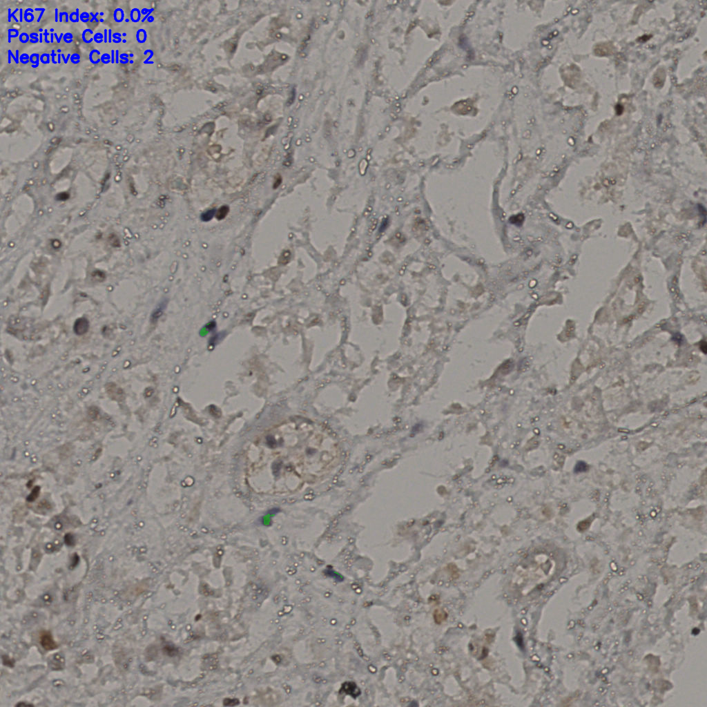 slice_28_38_x25088_y34048.png