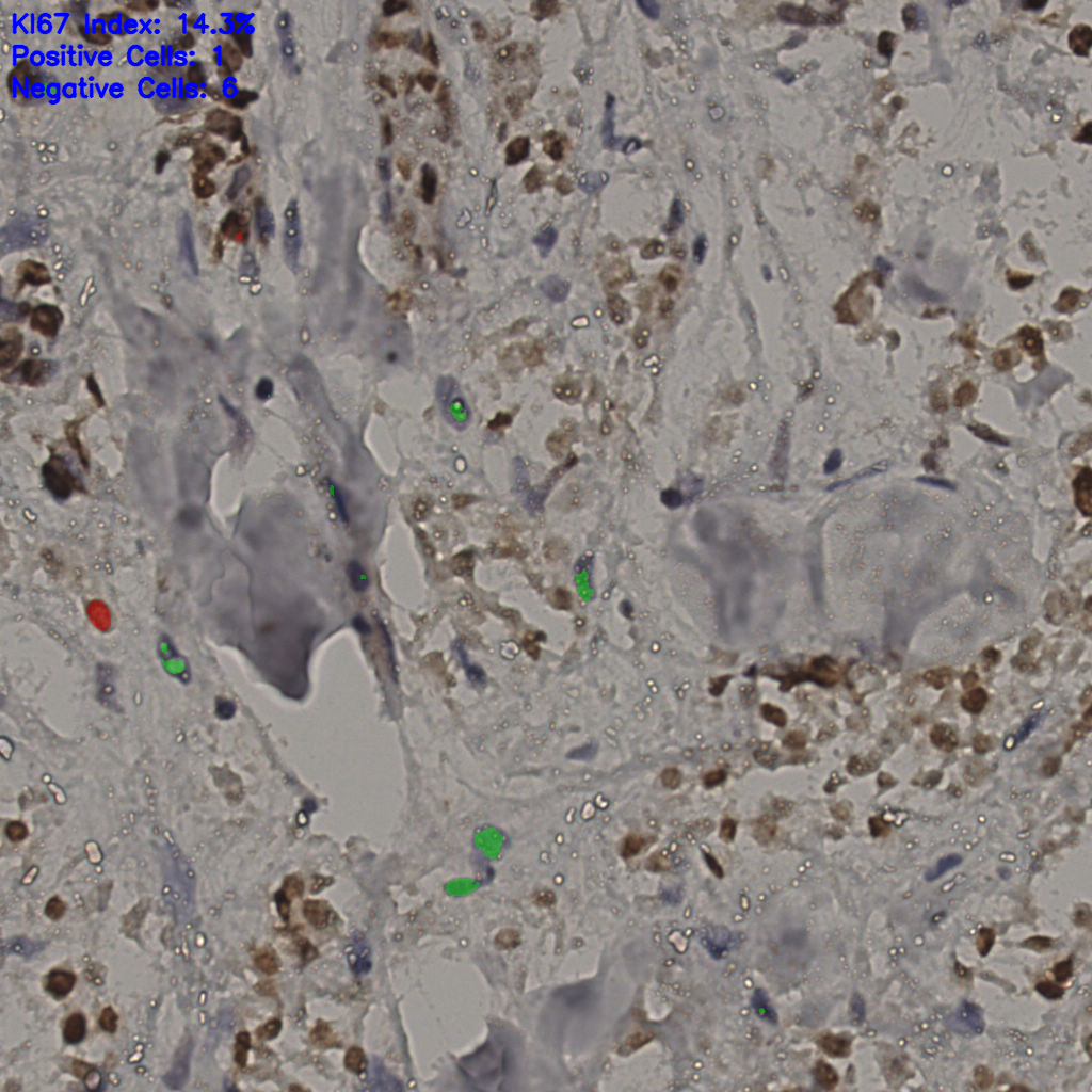 slice_29_21_x25984_y18816.png