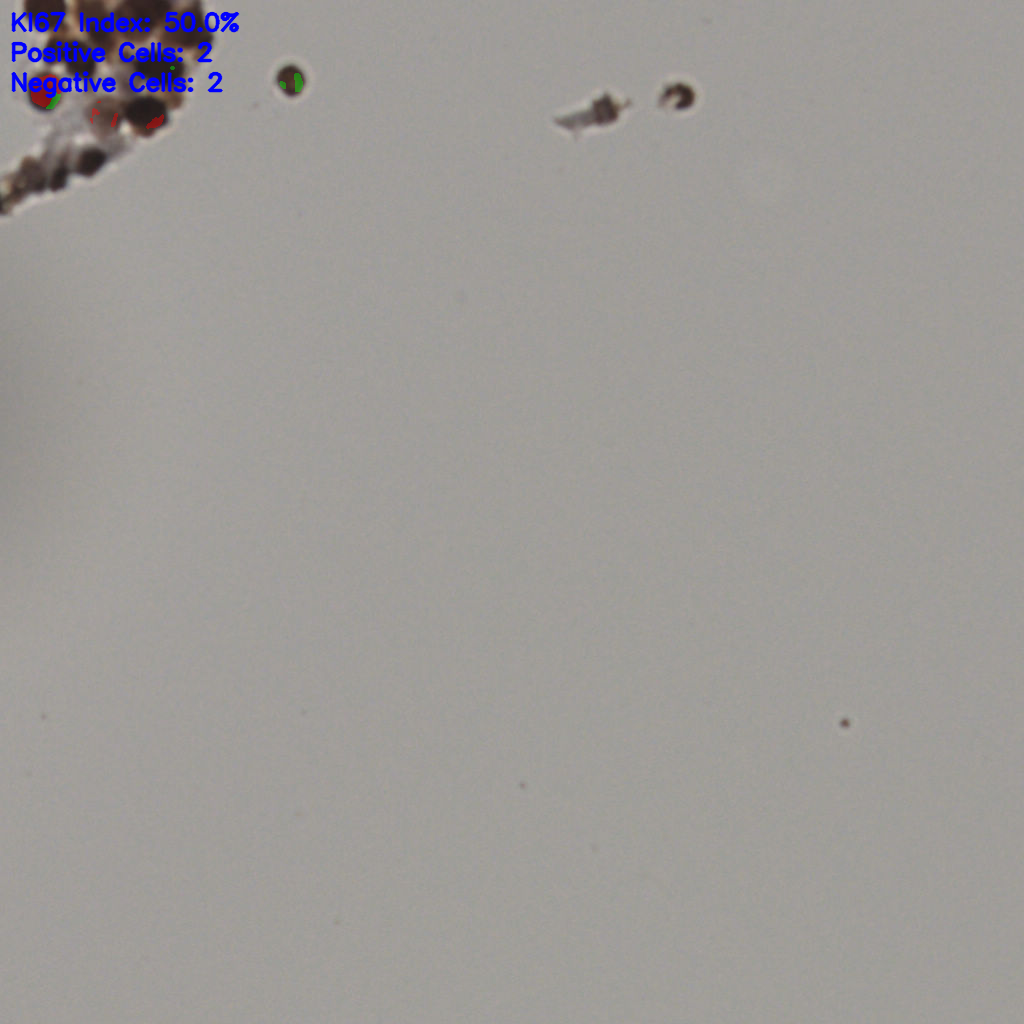 slice_2_6_x1792_y5376.png