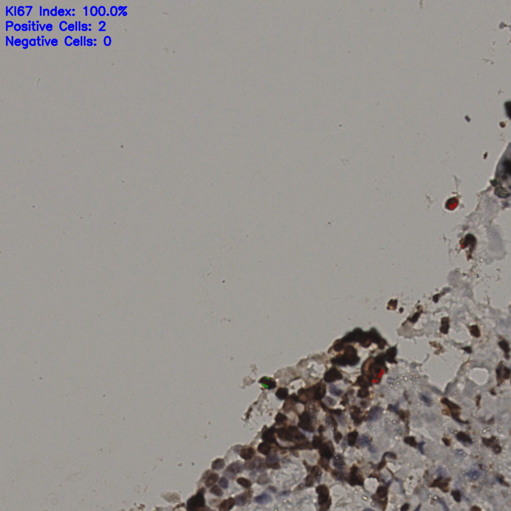 slice_30_18_x26880_y16128.png