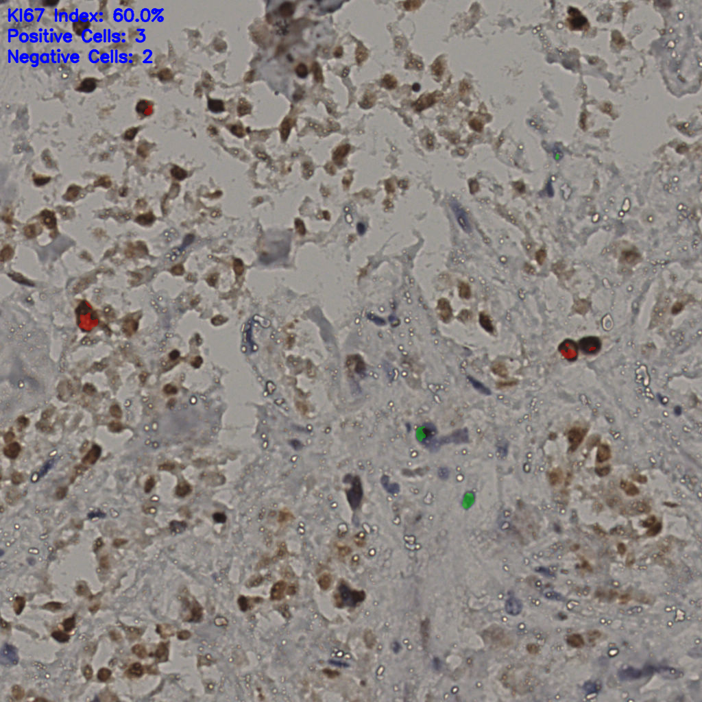 slice_30_21_x26880_y18816.png