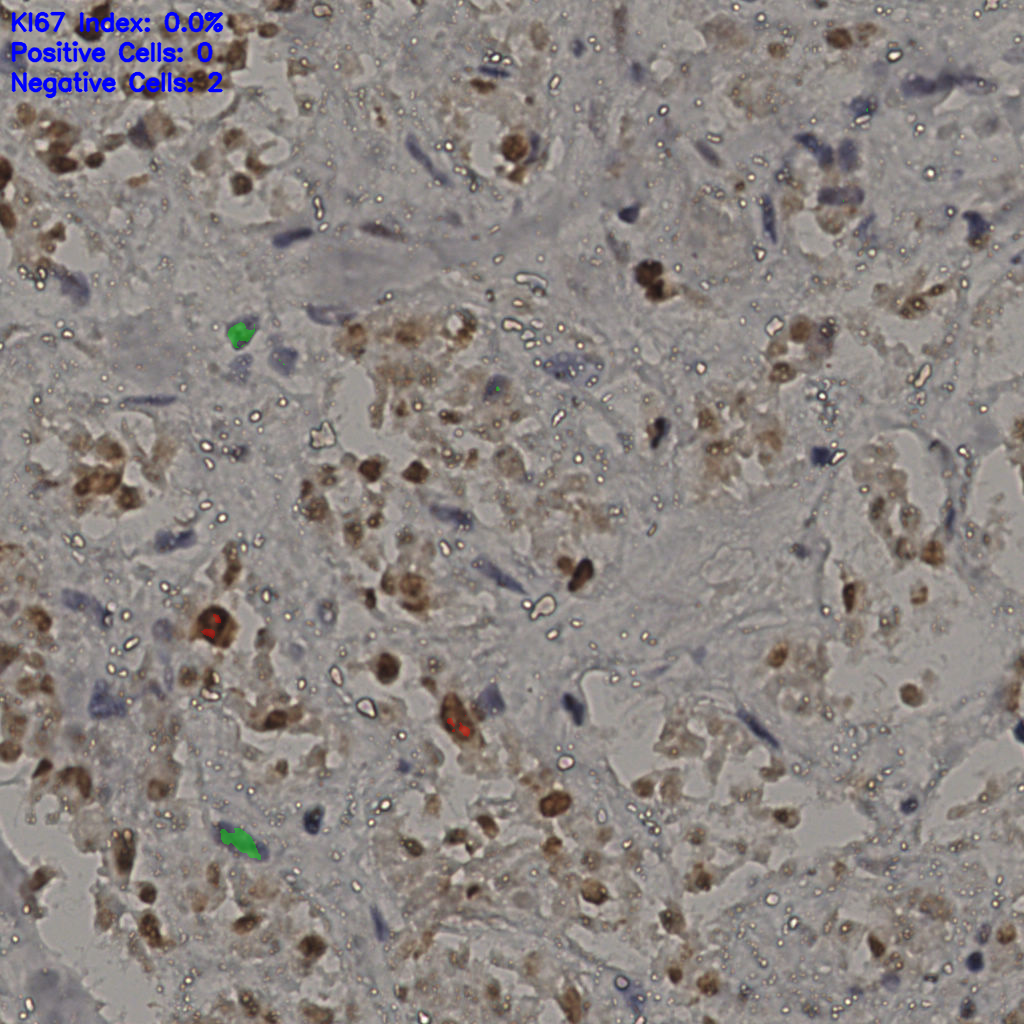 slice_30_22_x26880_y19712.png