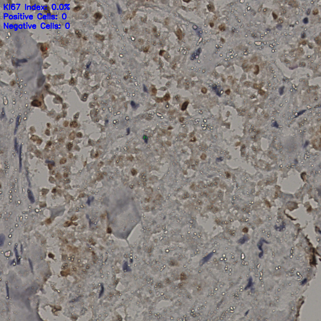 slice_30_23_x26880_y20608.png