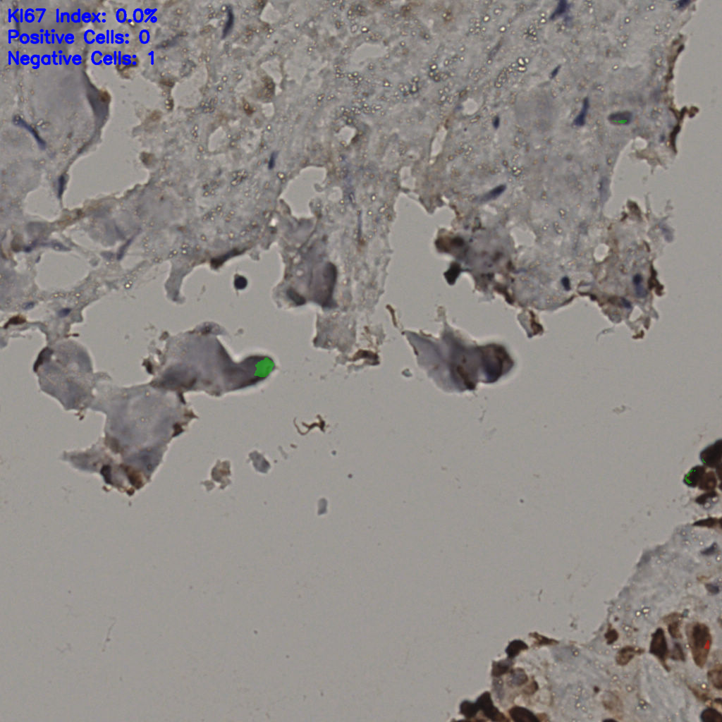 slice_30_24_x26880_y21504.png