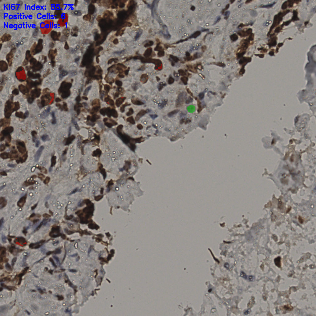 slice_30_30_x26880_y26880.png