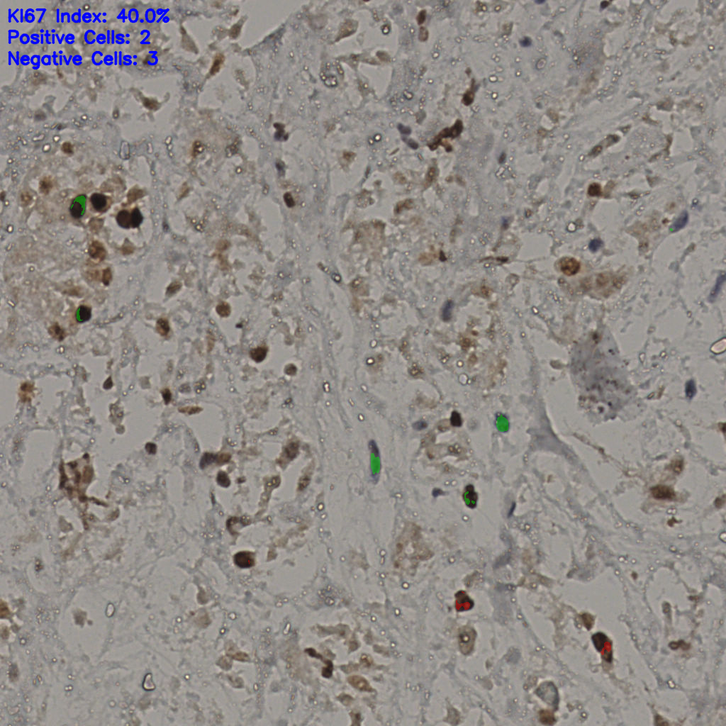 slice_30_32_x26880_y28672.png