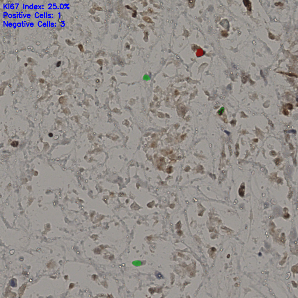 slice_30_33_x26880_y29568.png