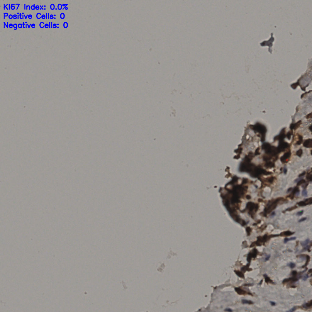 slice_31_16_x27776_y14336.png