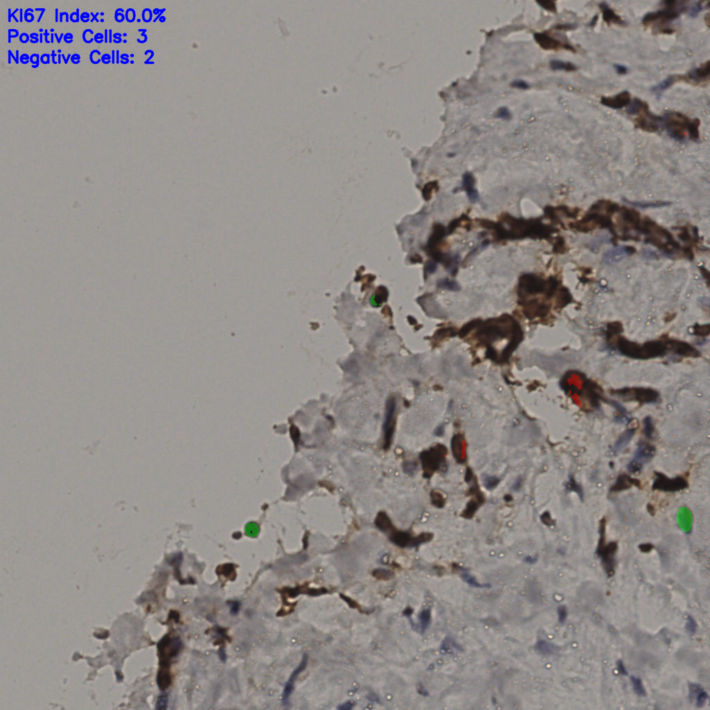 slice_31_17_x27776_y15232.png