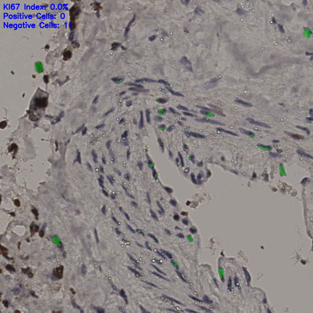 slice_31_18_x27776_y16128.png