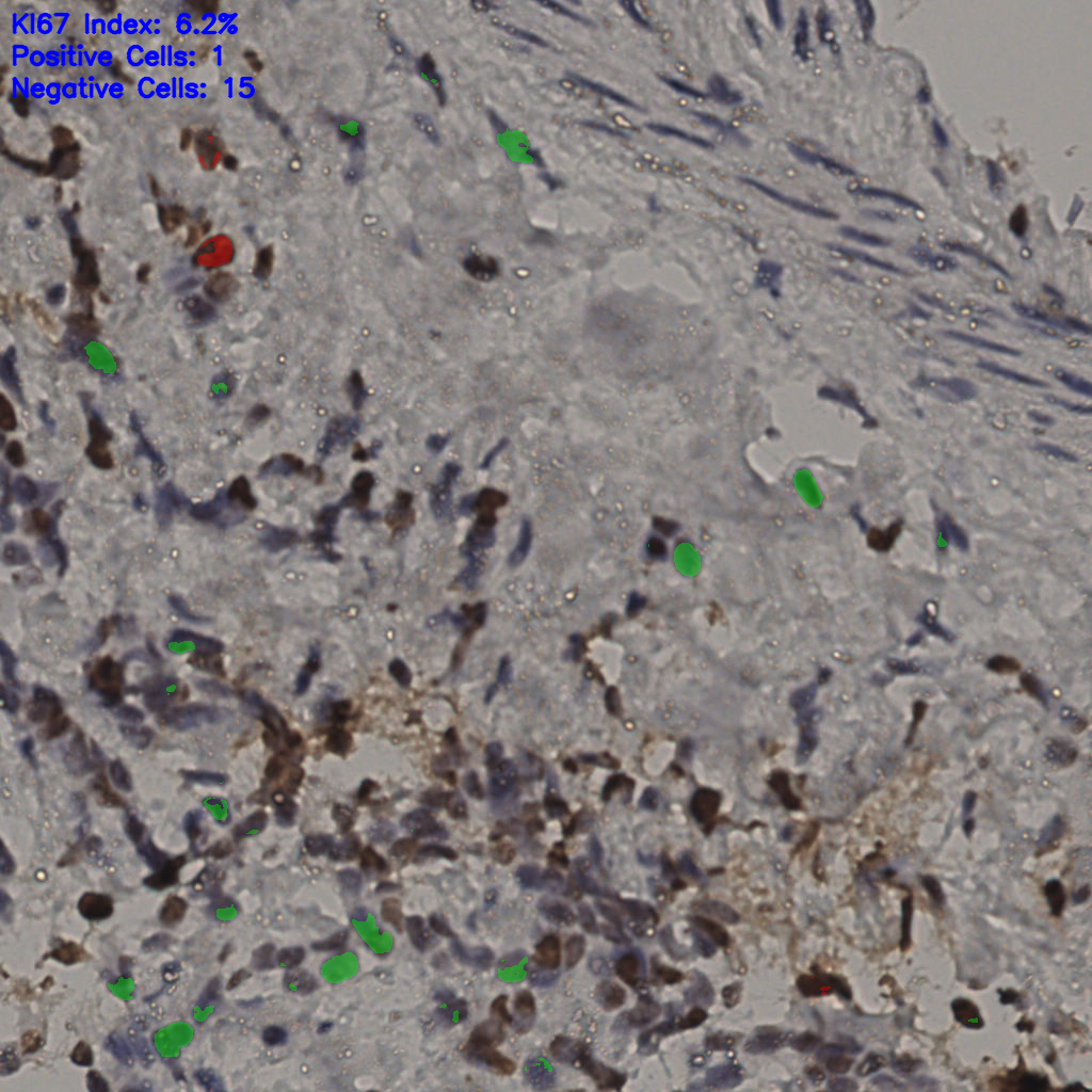 slice_31_19_x27776_y17024.png