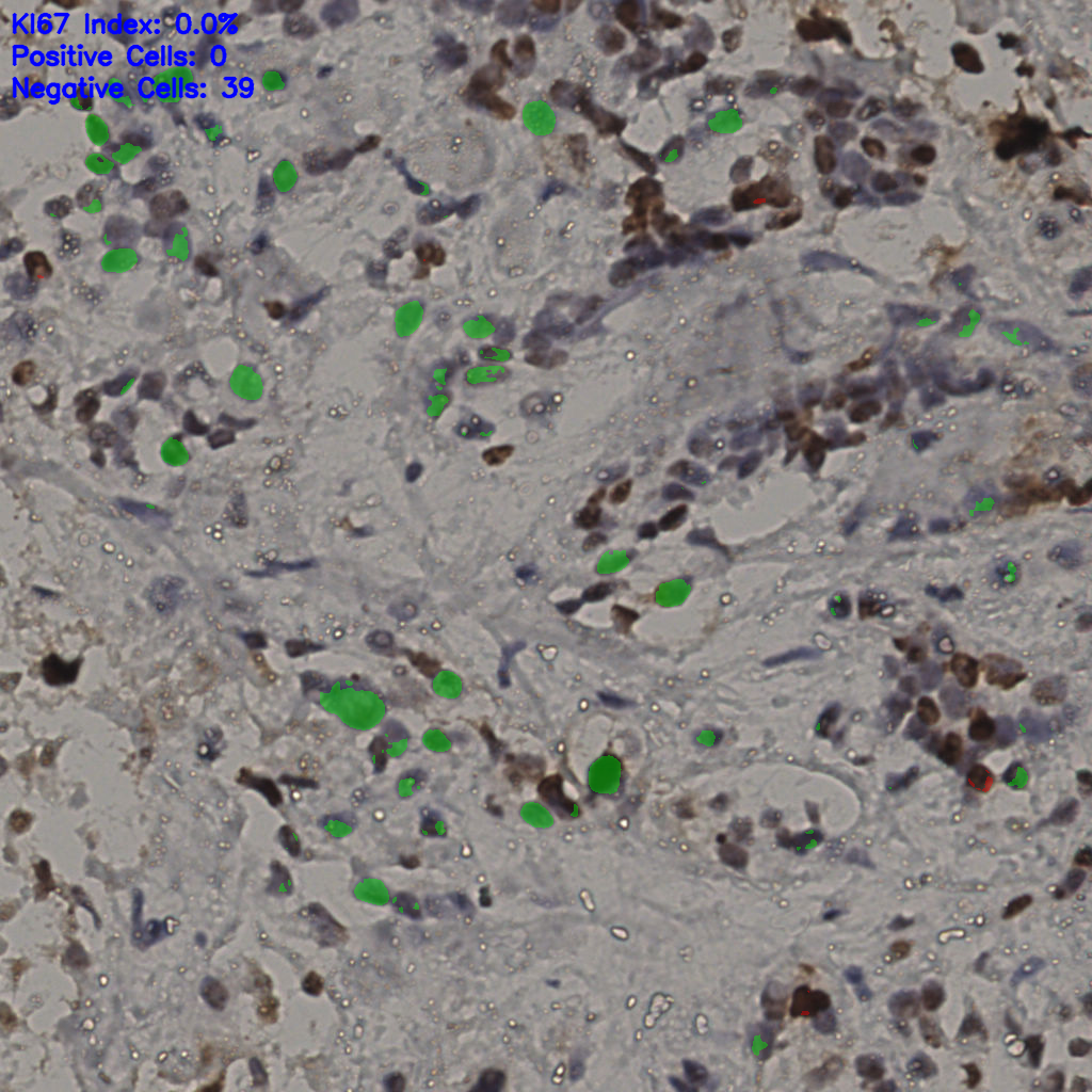 slice_31_20_x27776_y17920.png