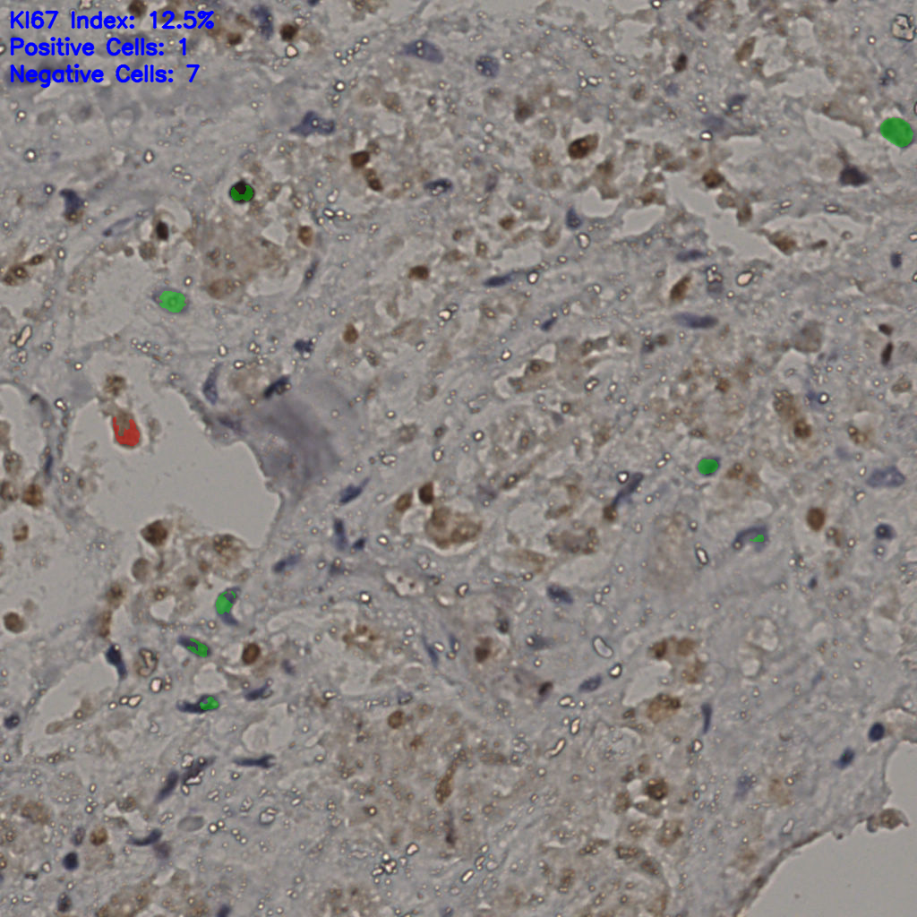 slice_31_22_x27776_y19712.png