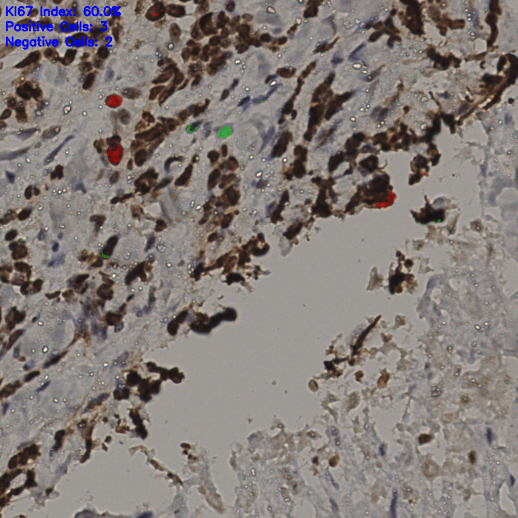 slice_31_29_x27776_y25984.png