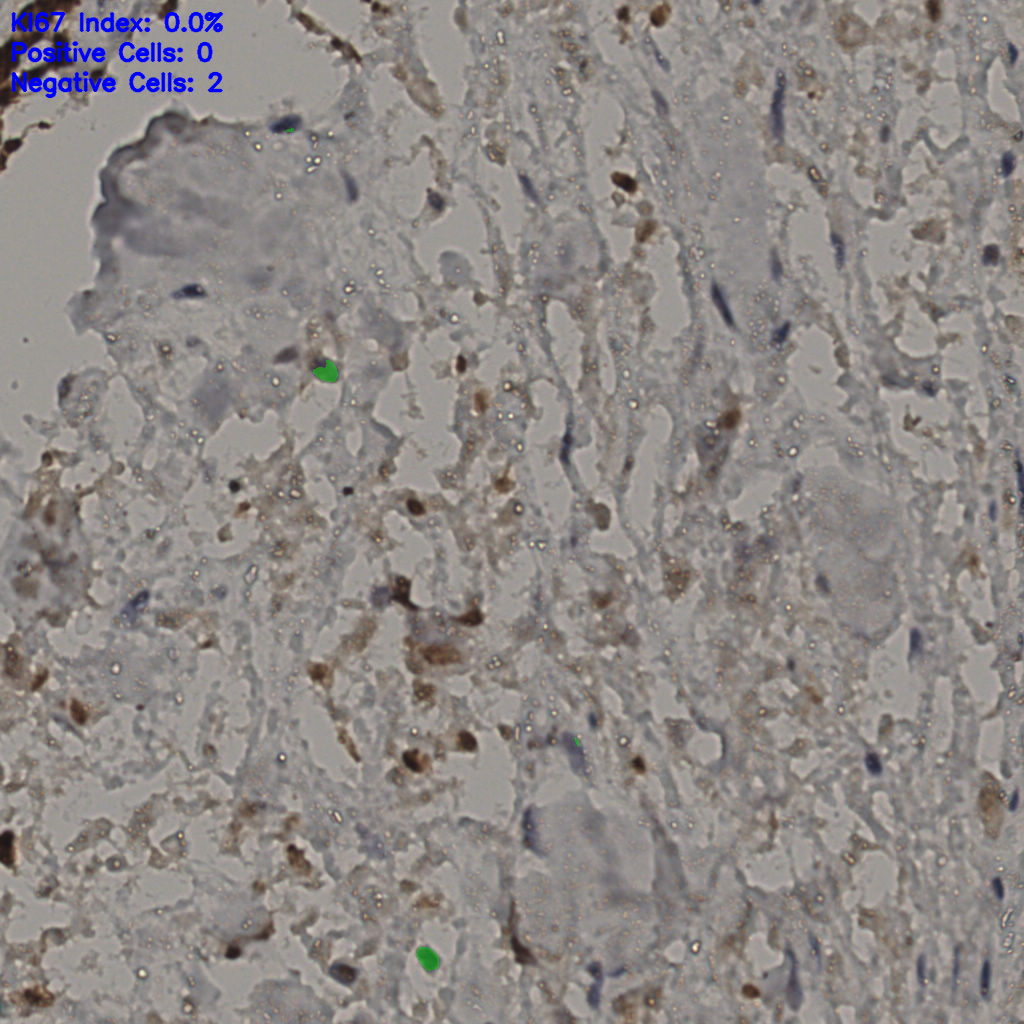 slice_31_30_x27776_y26880.png