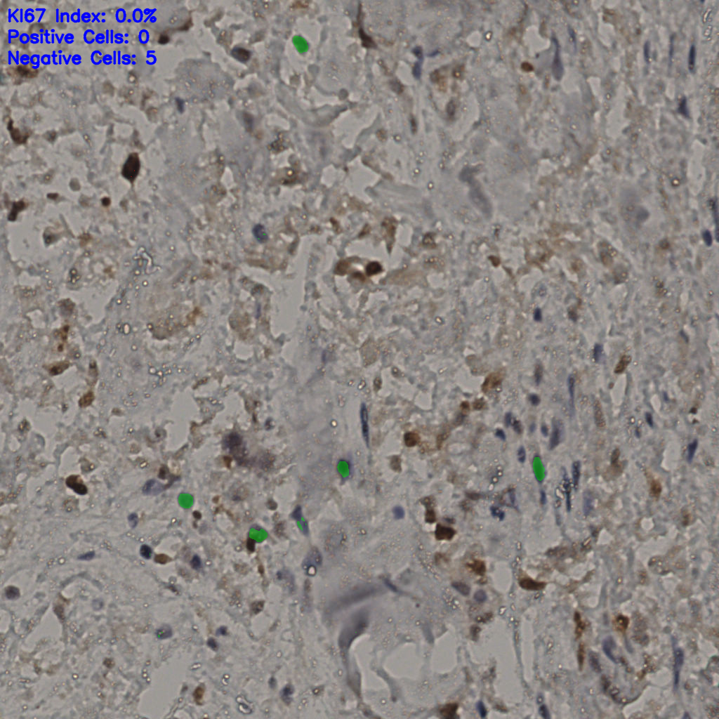 slice_31_31_x27776_y27776.png