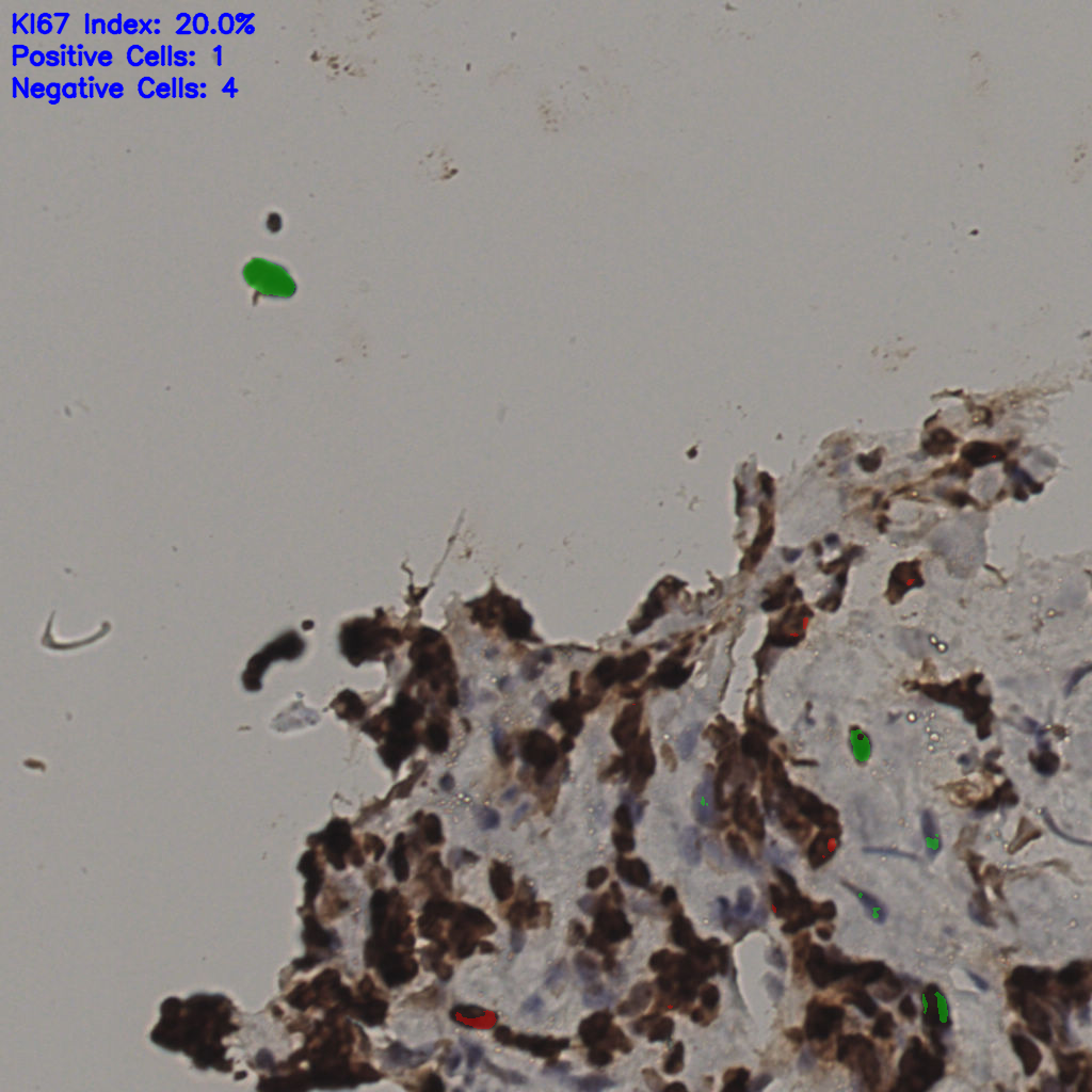 slice_32_13_x28672_y11648.png