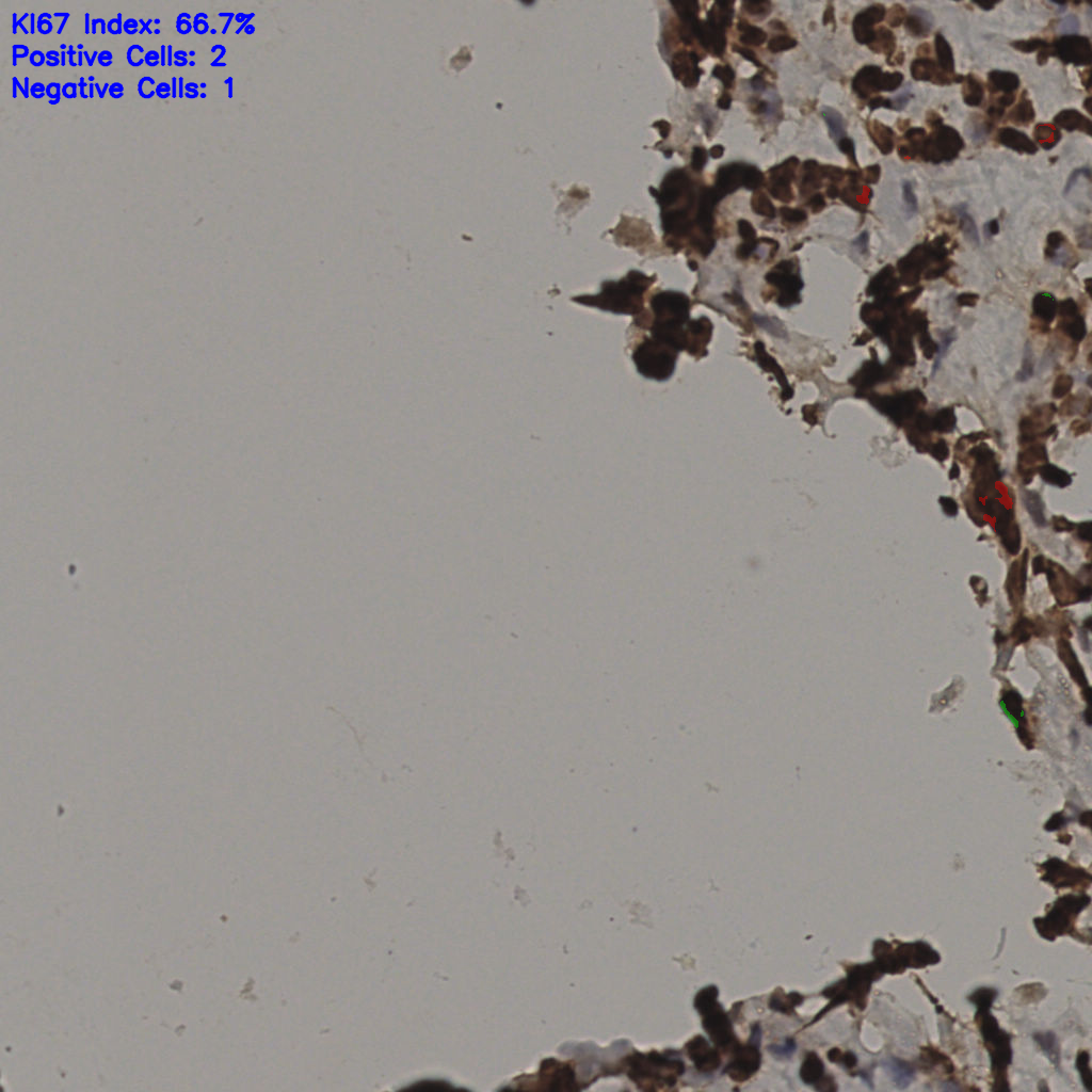 slice_32_15_x28672_y13440.png