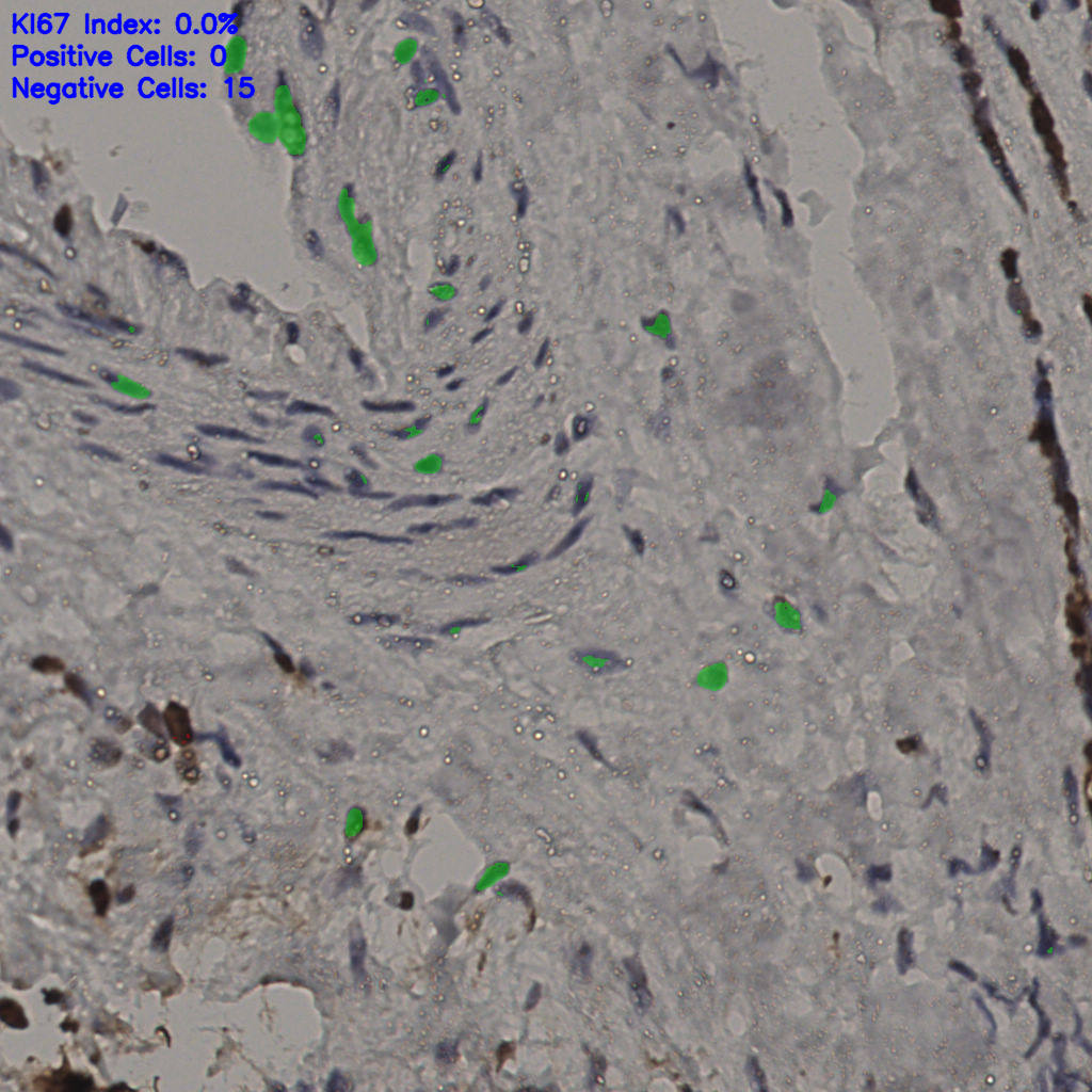slice_32_19_x28672_y17024.png