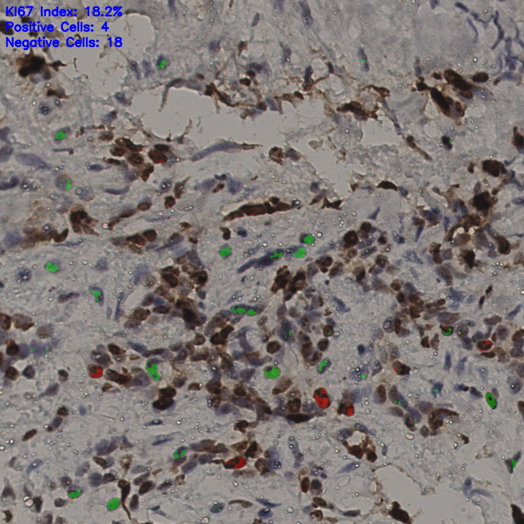 slice_32_20_x28672_y17920.png