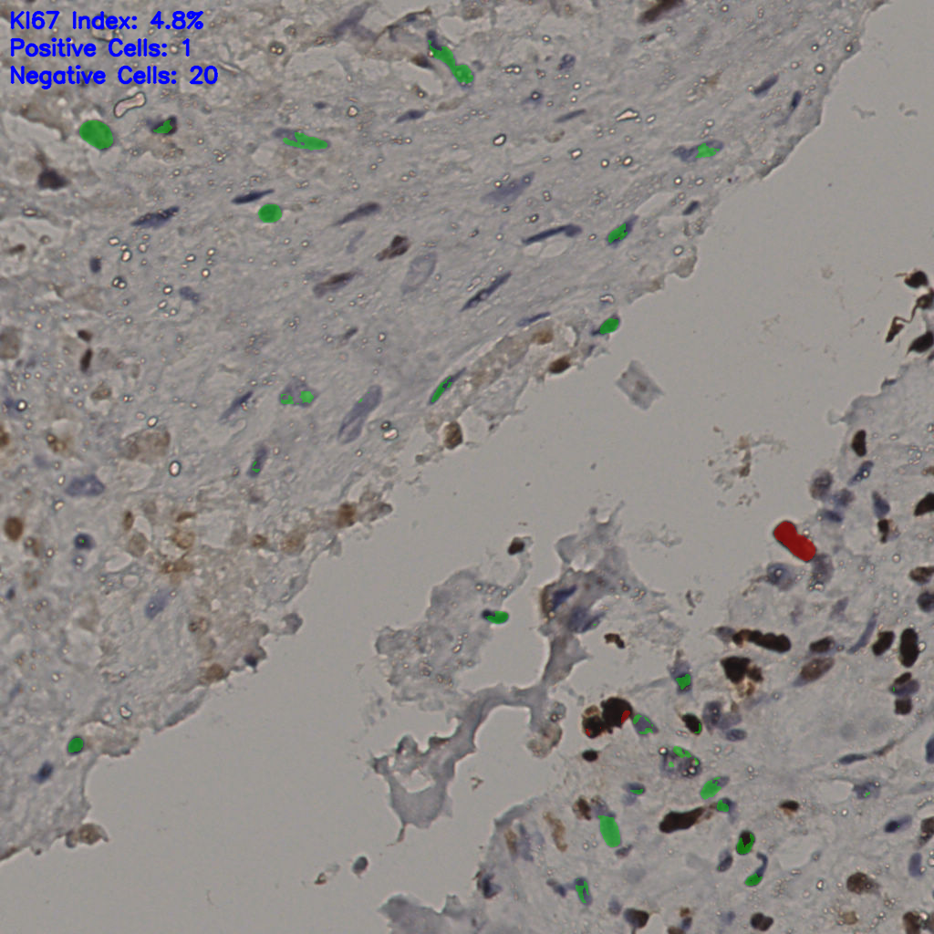 slice_32_22_x28672_y19712.png