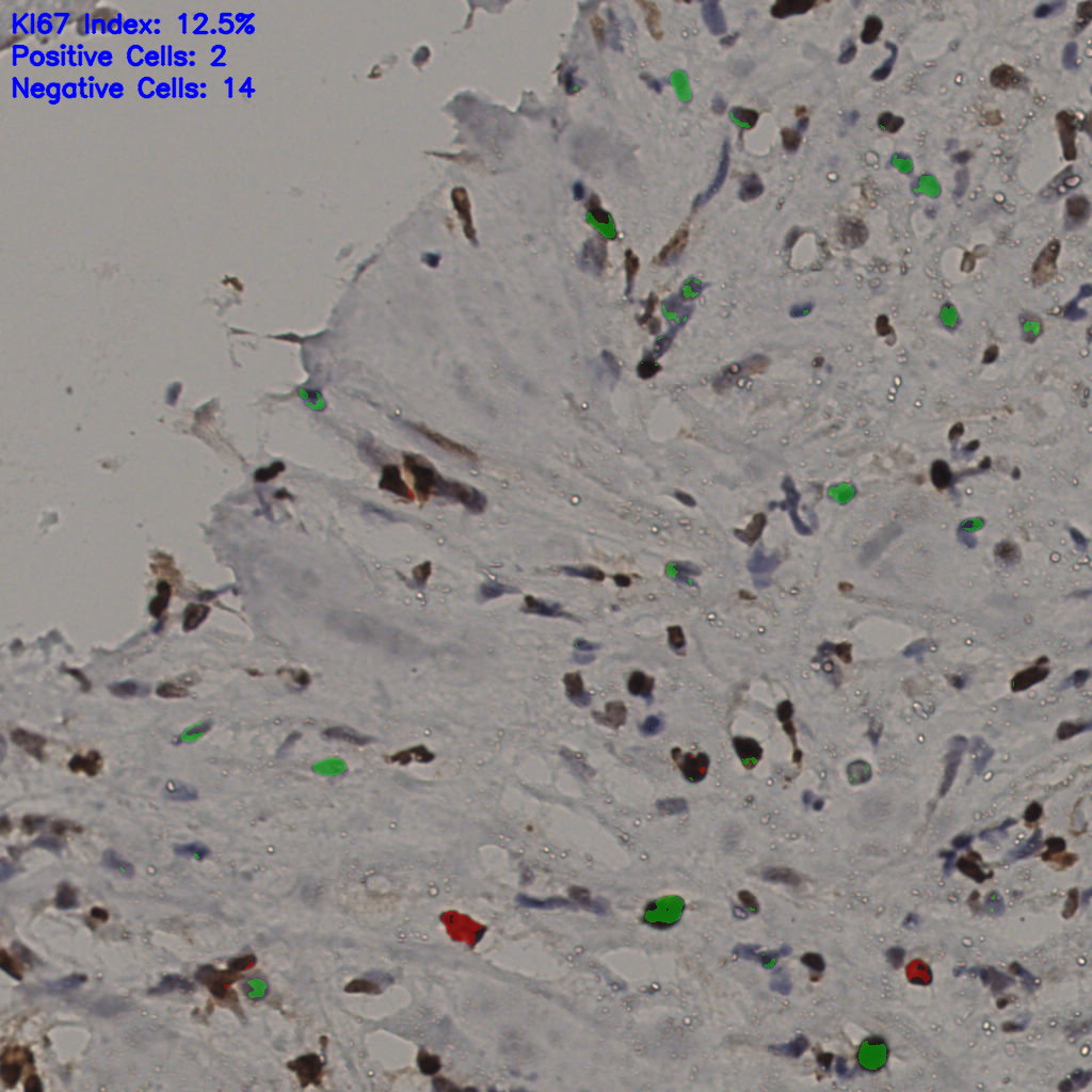 slice_32_23_x28672_y20608.png