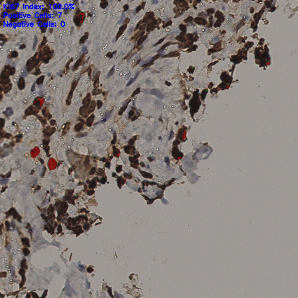slice_32_28_x28672_y25088.png