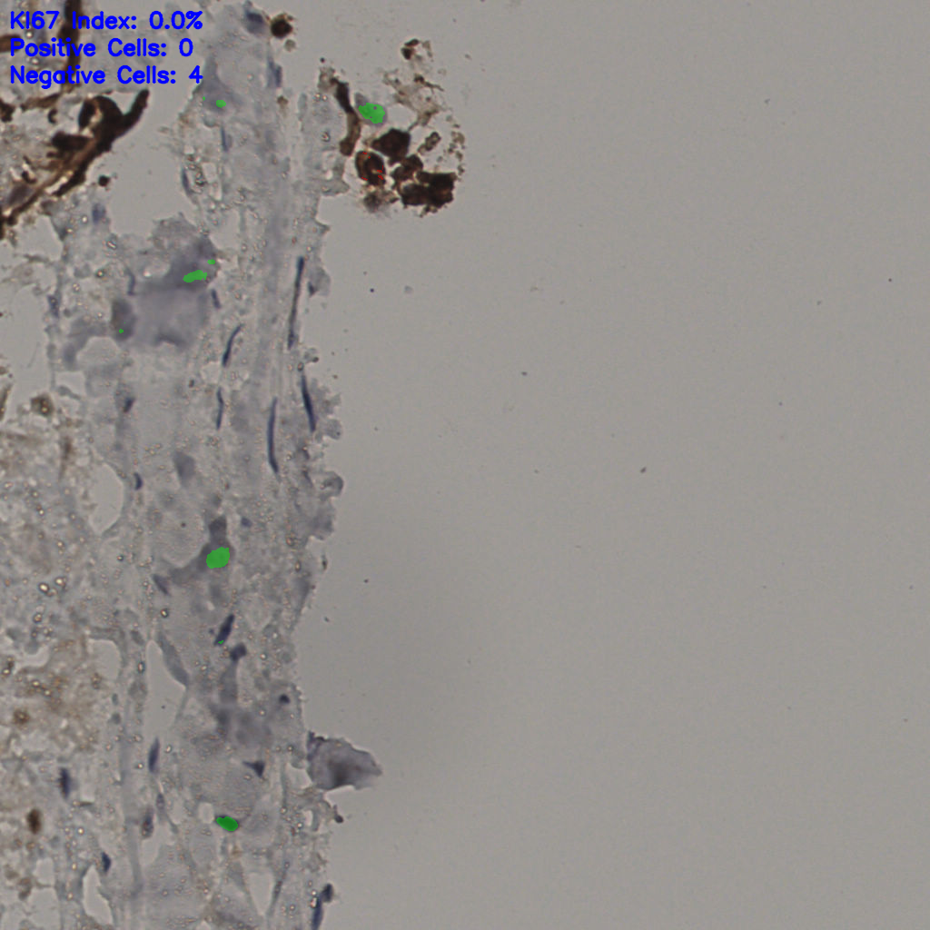 slice_32_29_x28672_y25984.png