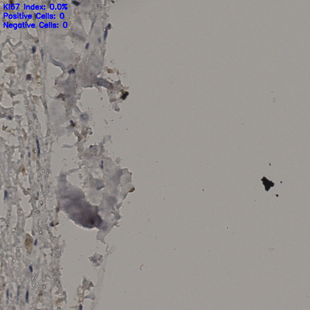 slice_32_30_x28672_y26880.png